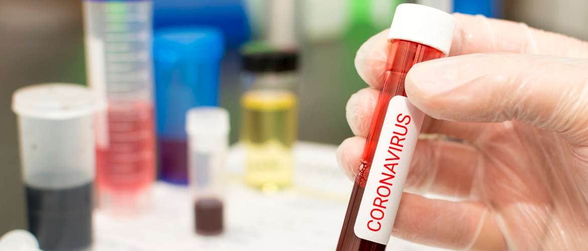 COVID-19: Saiba quais tecnologias podem prevenir epidemias como o coronavírus